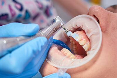 Person Having a Dental Cleaning